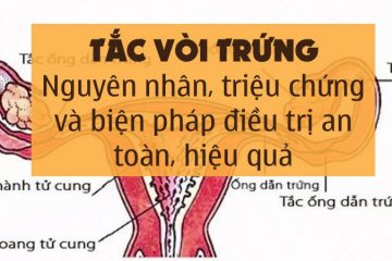 Tắc vòi trứng (tắc ống dẫn trứng): nguyên nhân, triệu chứng