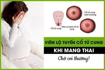 Viêm lộ tuyến cổ tử cung khi mang thai: Bà bầu cần làm gì?