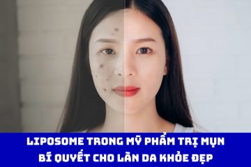 Liposome trong mỹ phẩm trị mụn: Bí quyết cho làn da khỏe đẹp