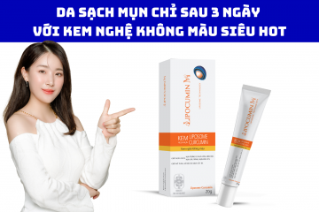 Da sạch mụn chỉ sau 3 ngày với kem nghệ không màu siêu hot